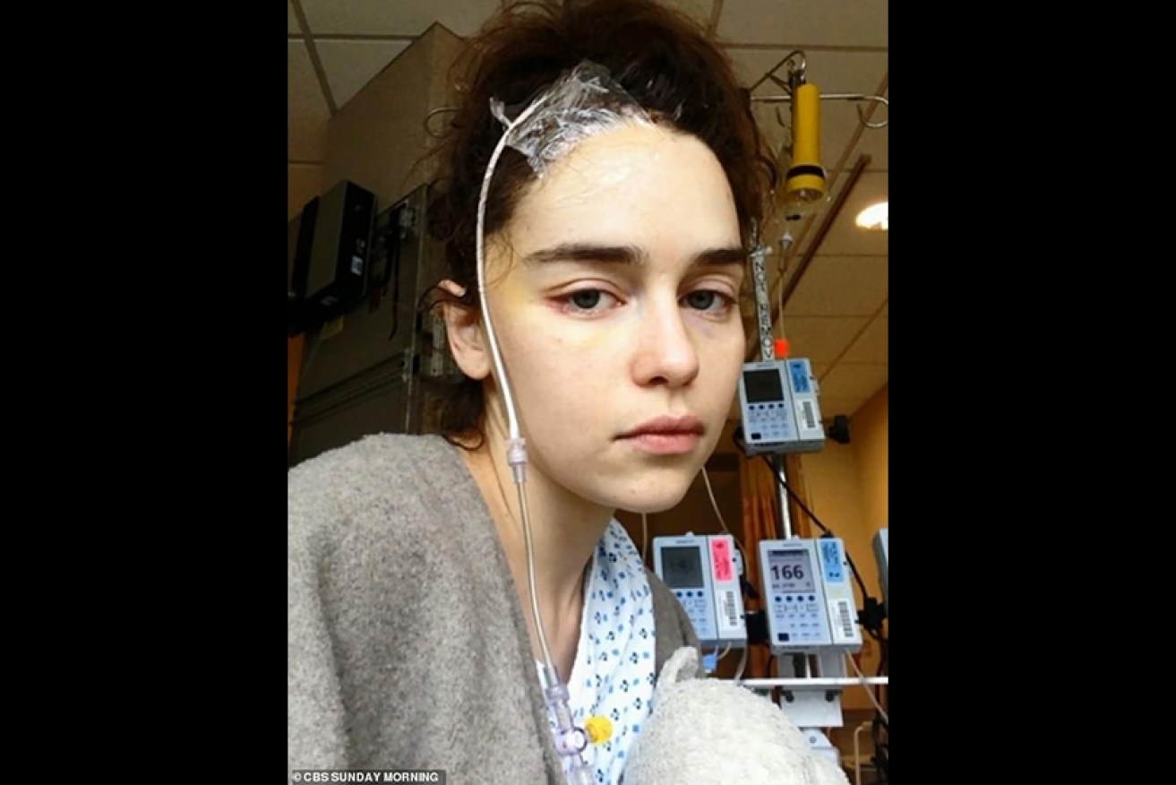 Emilia Clarke has spoken out about her treatment for a brain aneurysm. 