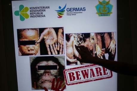 No evidence monkeypox has mutated, WHO says