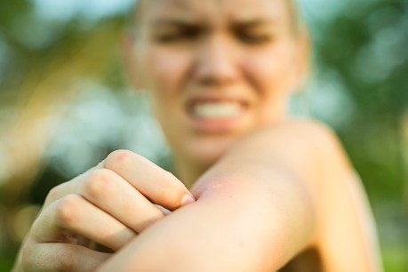 Stickers and wristbands aren’t a reliable way to prevent mosquito bites. Here’s why