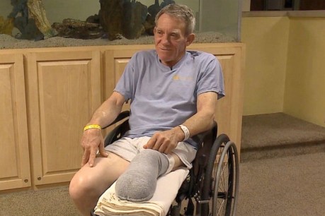 Farmer cut his leg off to save his life 