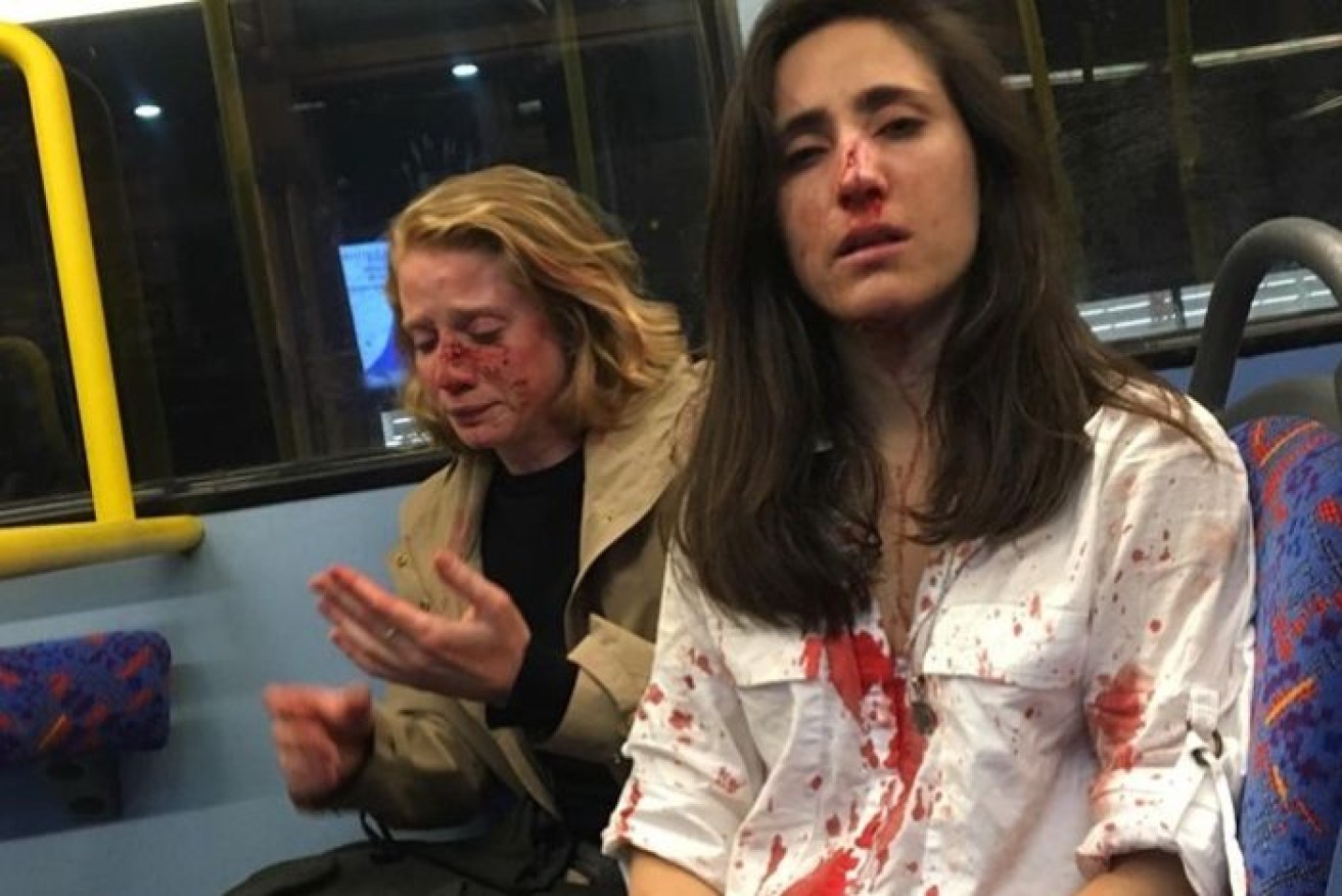 Melania Geymonat and girlfriend Chris were attacked on a London bus while on a date. 