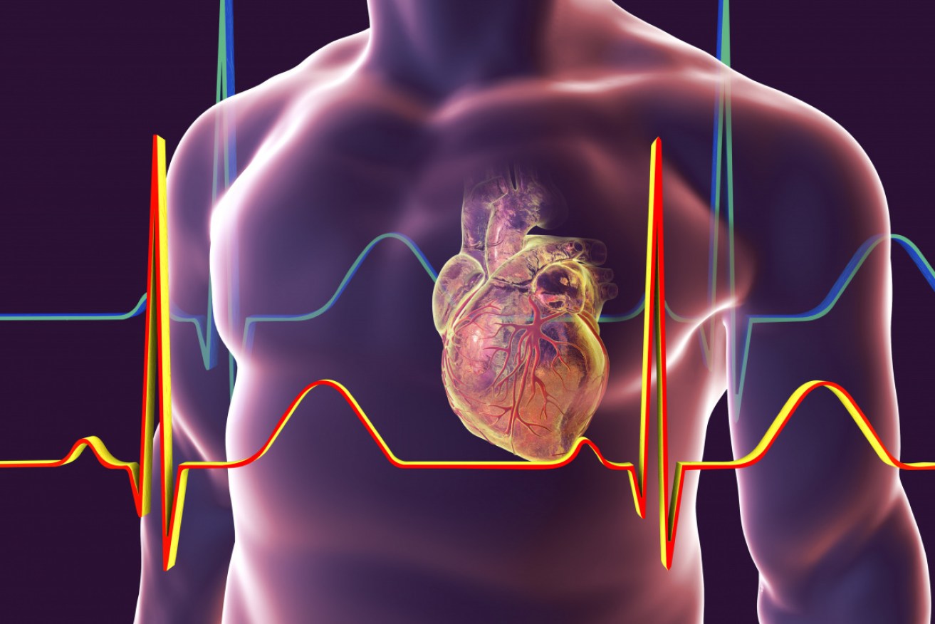 A massive international study could lead to routine heart surgeries and interventions being abandoned. 