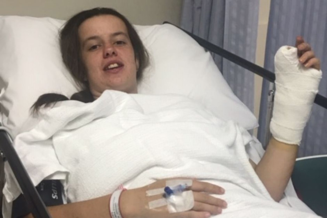 Teenager Britney Thomas lost her thumb after routine surgery went wrong.