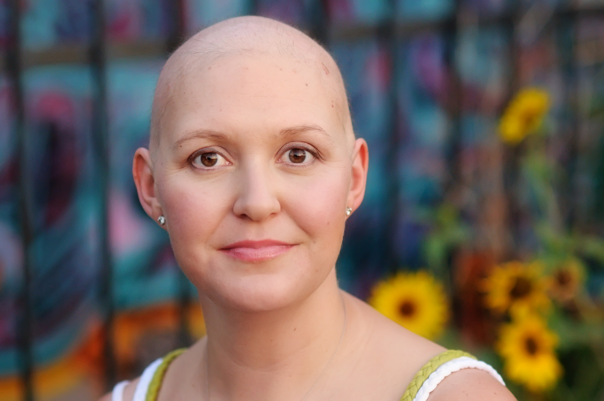 step-closer-to-preventing-hair-loss-hope-for-chemo-patients