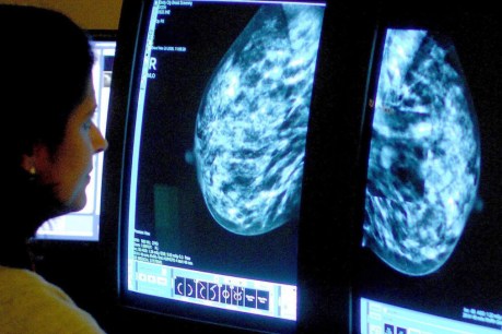 Delayed breast cancer testing could cost ‘hundreds of lives’