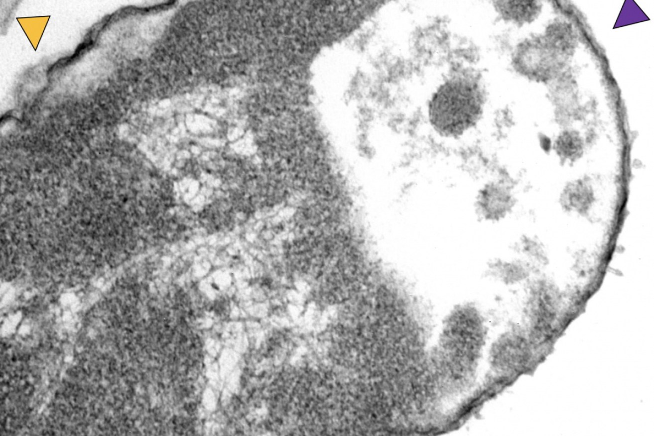 A Klebsiella pneumoniae bacteria exposed to motorised nanomachines and the antibiotic meropenem shows signs of damage in a transmission electron microscope image.