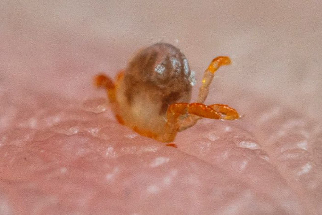 Ticks can be hard to clock – in reality this one would be smaller than a poppyseed.
