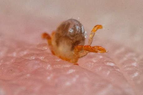 Tick bites can make you really sick. Here&#8217;s how to deal with them