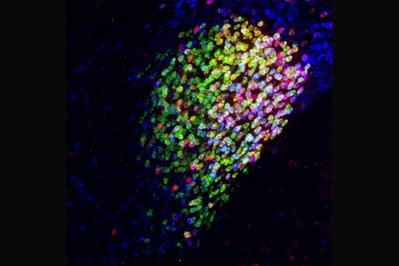 Red, magenta and yellow cells in a mouse brain: Neurons that have potent pain-suppression abilities. 