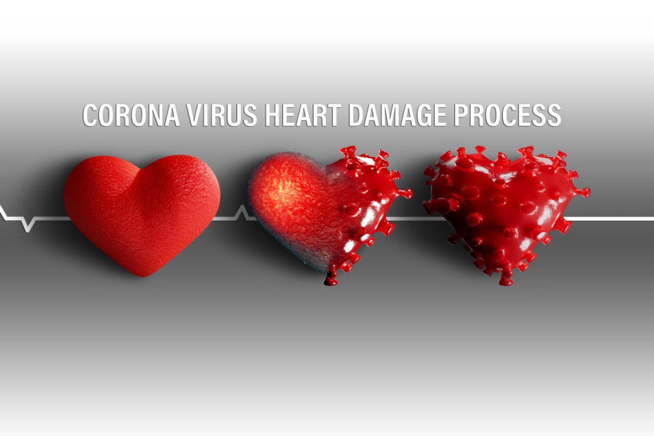 There is growing evidence that COVID-19 isn't always primarily a respiratory disease. Many patients are showing heart damage. 