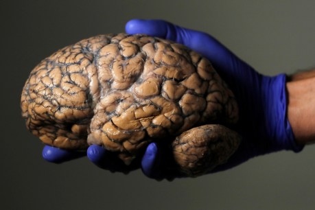 Are there ‘male’ and ‘female’ brains? Yes, sort of