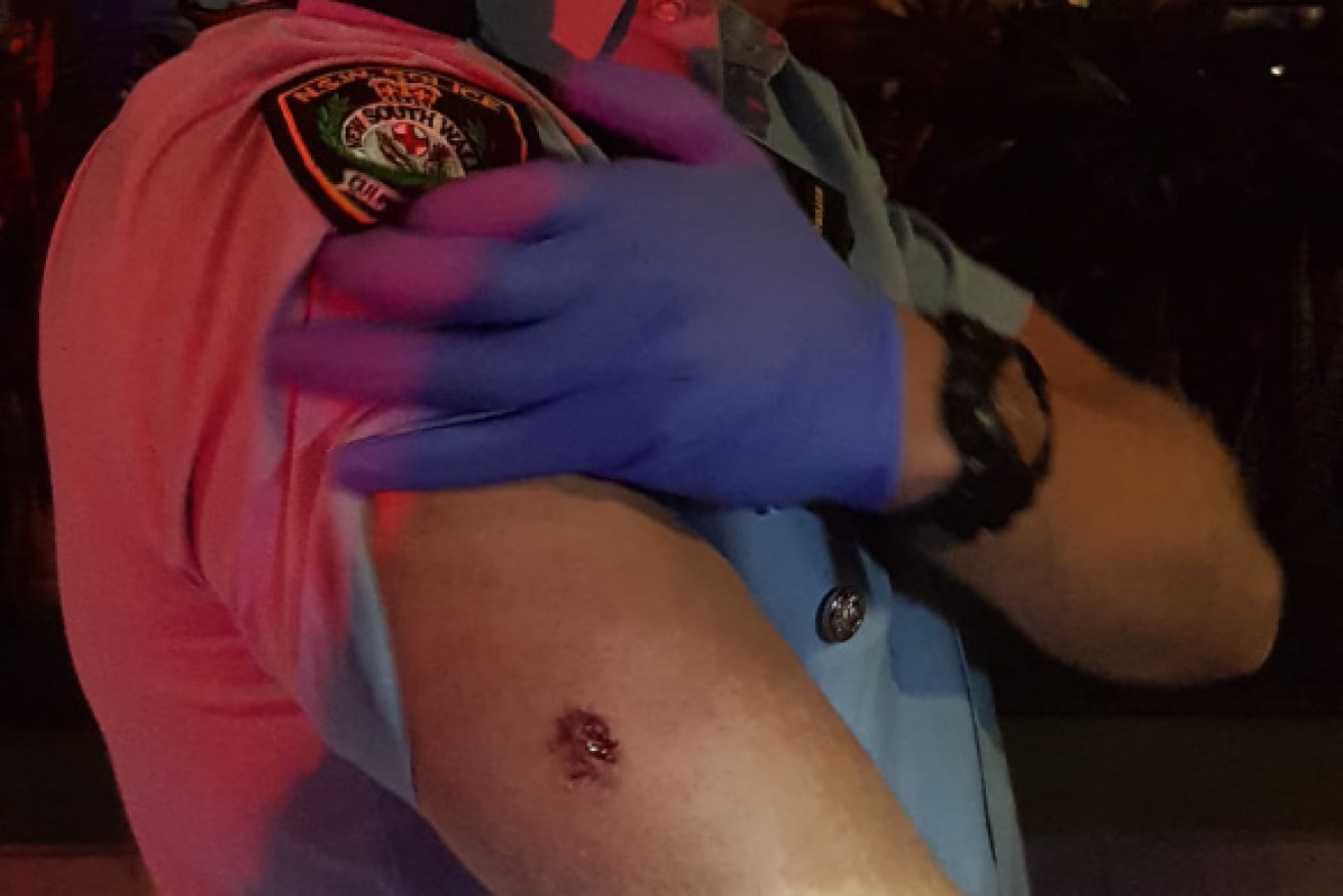 A police officer was allegedly bitten on the arm by the offender. 