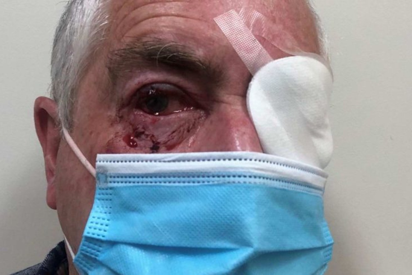 James Glindemann was attacked by a magpie outside of a shopping centre in eastern Victoria.