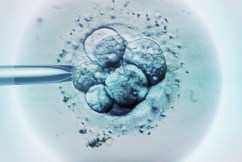  'Eureka moment': Human embryos created in lab