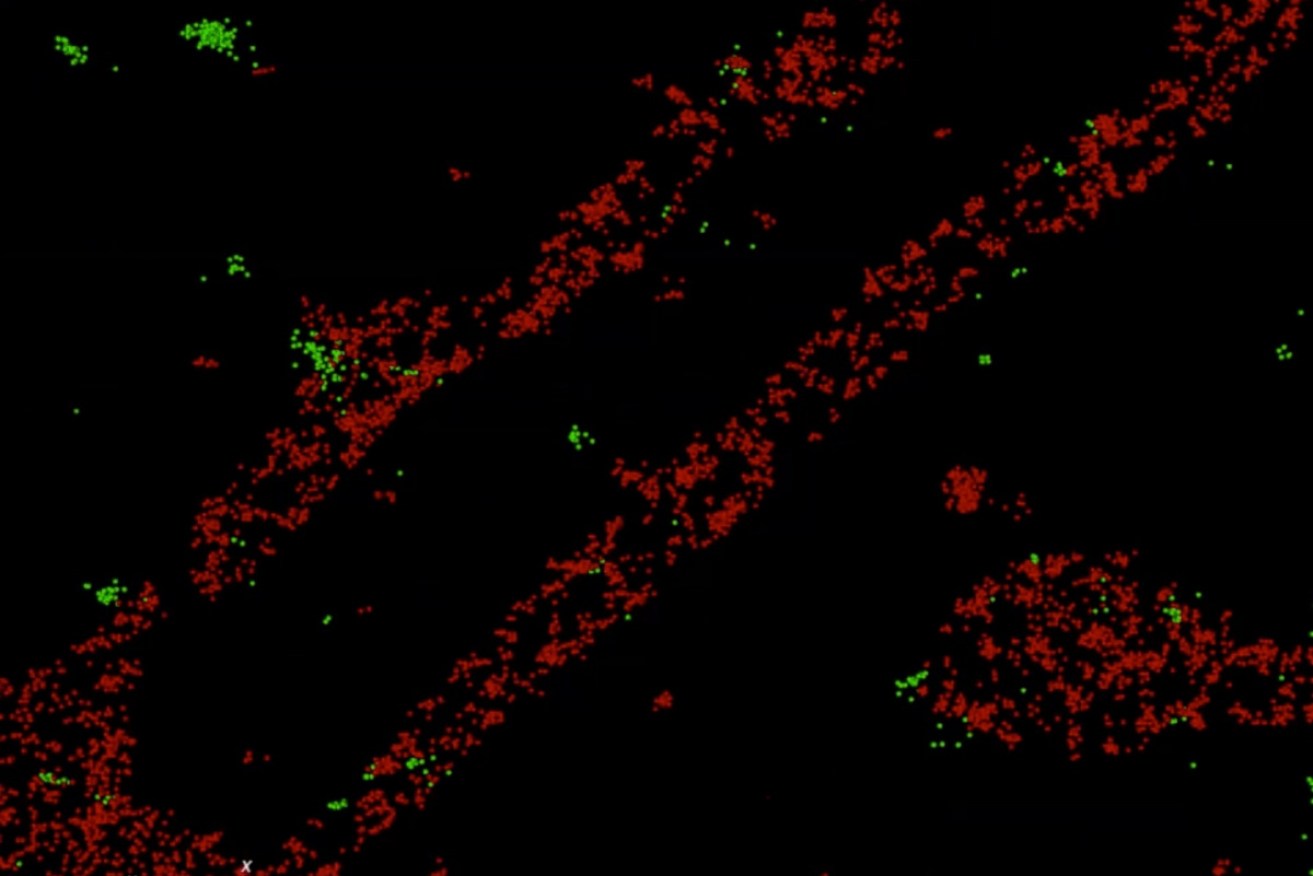Gonorrhoea-causing bacteria and their vesicles interacting with immune cells.