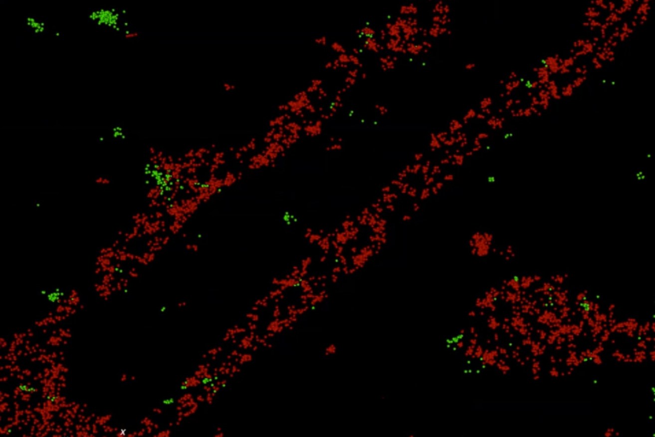 Gonorrhoea-causing bacteria and their vesicles interacting with immune cells. 