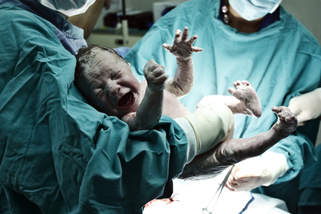 Doctors are concerned by the number of planned, non-medically necessary early births.