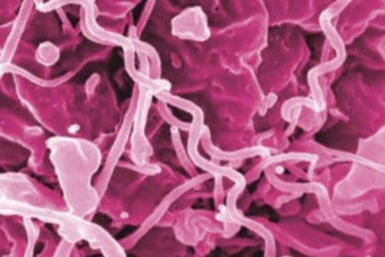 Syphilis is easily detected through sexual health tests and can be quickly treated if caught in time.