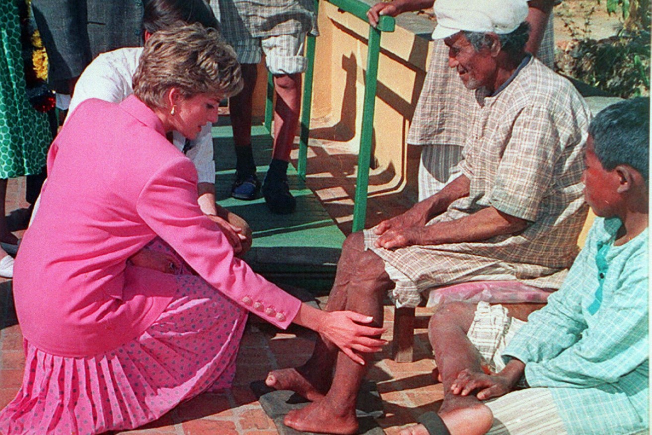 Princess Diana visits a leprosy hospital in Kathmandu.