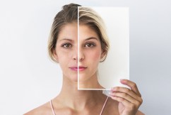 Patients more optimistic than AI about facelifts