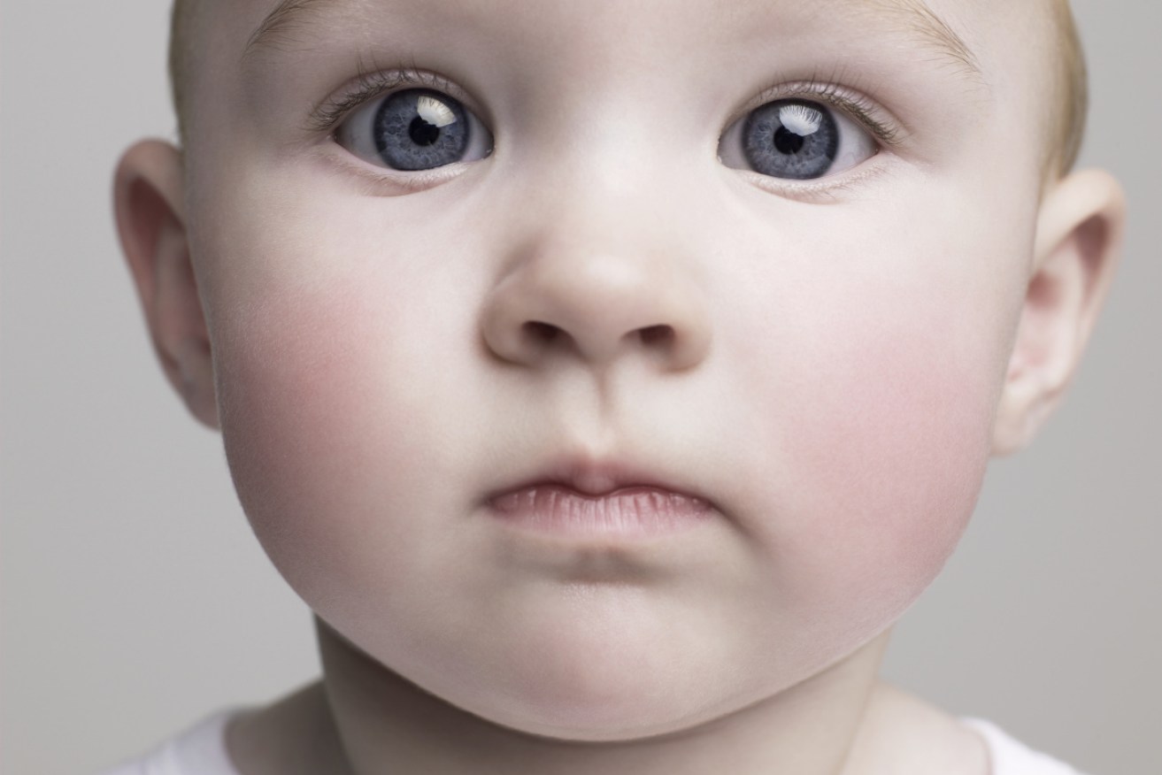 The likelihood of an autism diagnosis among babies at risk was cut by two-thirds.