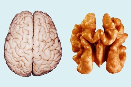 Walnuts look like brains and may boost memory