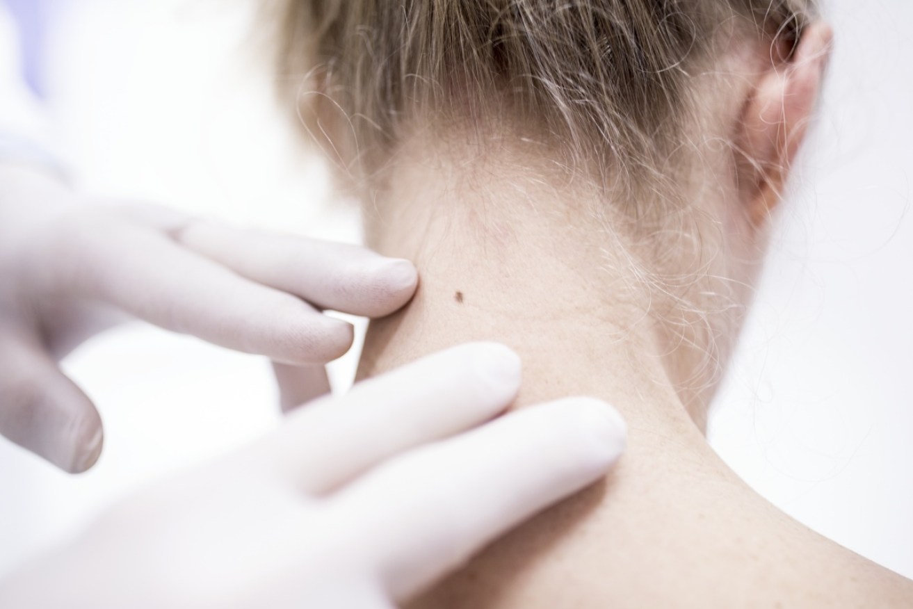 Squamous cell carcinomas are most often found on the neck, ears, nose and eyes. 