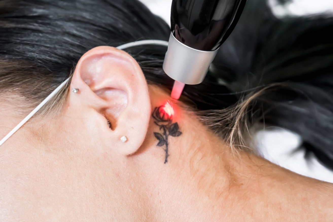 One in three tattooed people want one removed, according to YouGov research. 