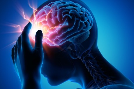 Migraine sufferers have treatment choices &#8211; a neurologist explains options beyond pain medication