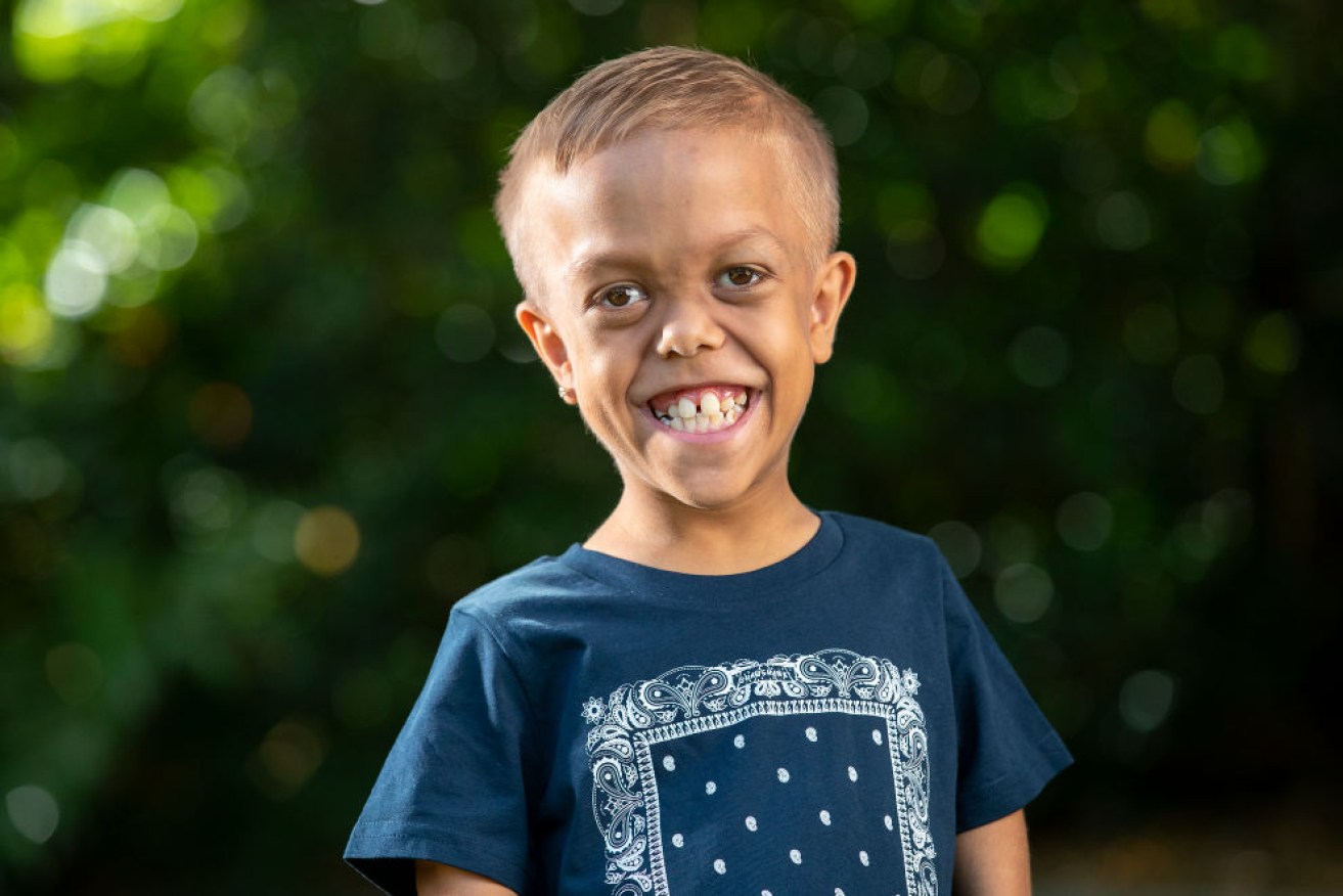 Quaden, who was born with achondroplasia dwarfism and is from the Wirri nation in Queensland, has small roles in two films.