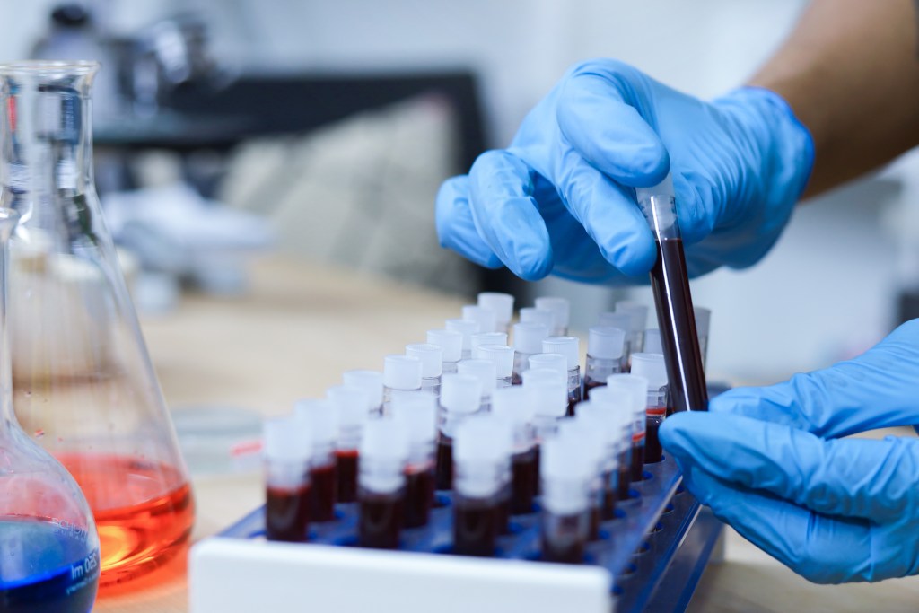 blood test