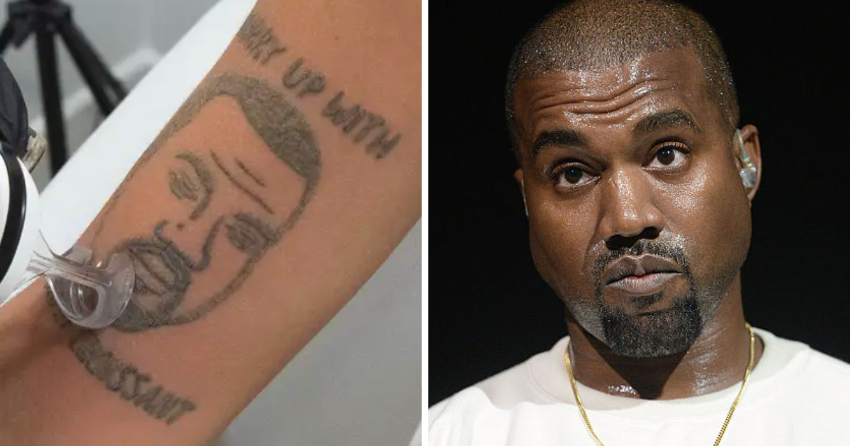 tattoo-removal-studio-offers-to-remove-kanye-ink-for-free