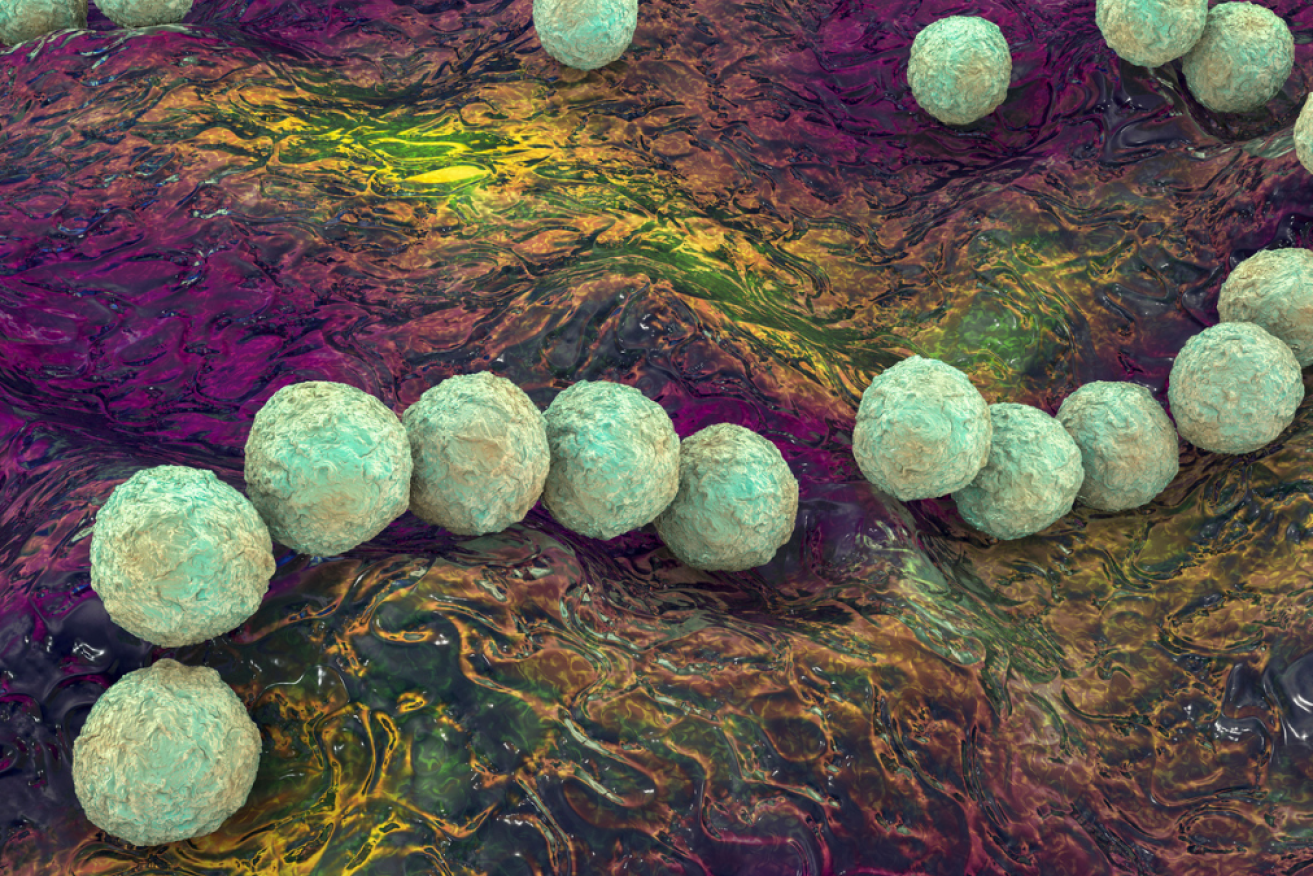 Invasive Strep A 'Intense' surge in cases, mainly in children