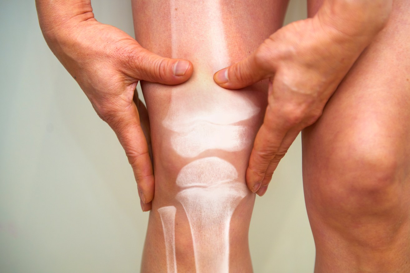 Osteoarthritis cripples more than half a billion people worldwide. It's curable in mice. And maybe one day in people.  