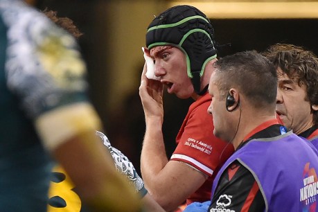 Better technique will reduce rugby head injuries