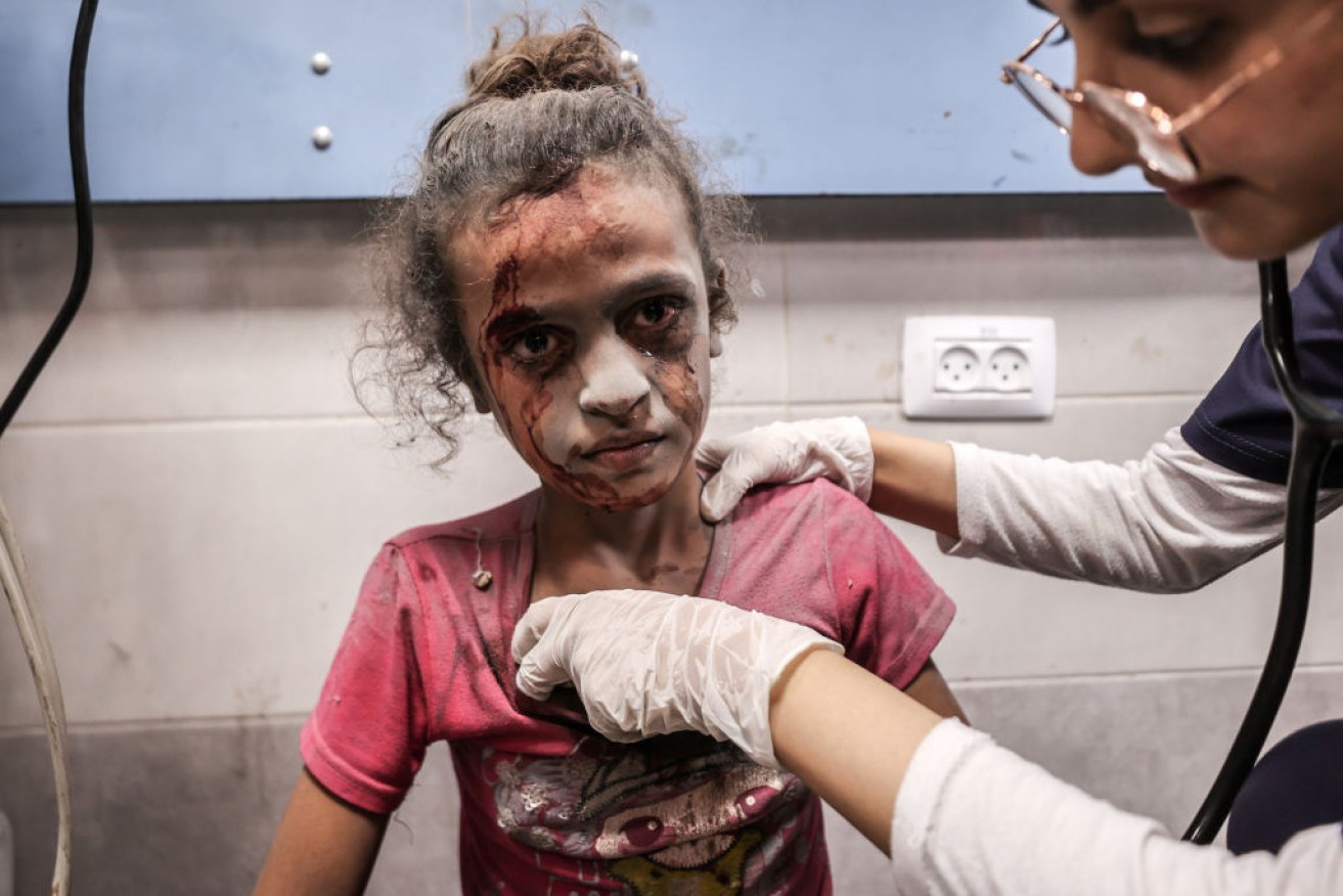 A child at Al-Shifa Hospital after an Israeli attack in Gaza.