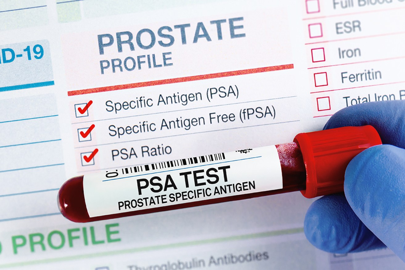 All men visiting doctors about prostate cancer should request a Prostate Specific Antigen (PSA) test.