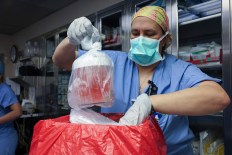 First pig kidney transplant patient dies