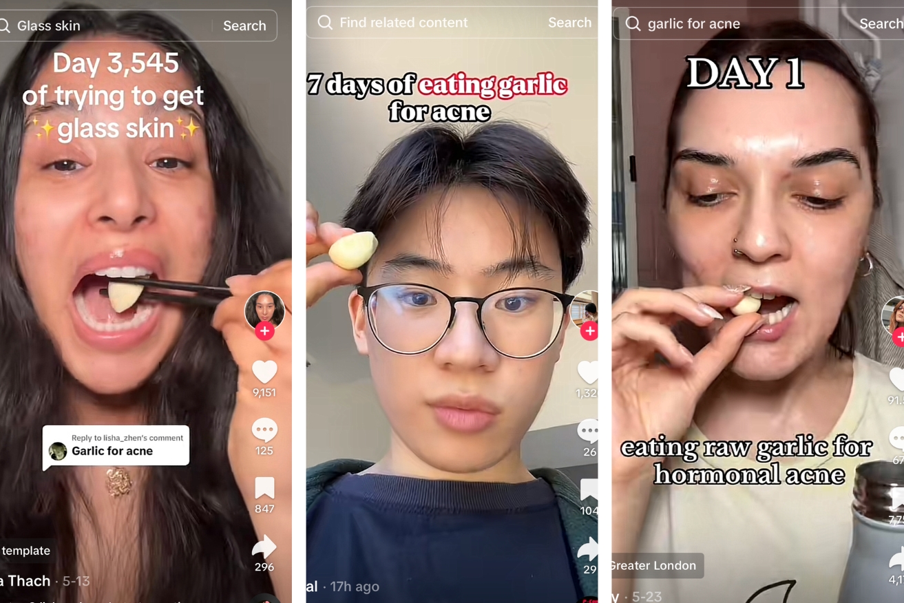 TikTokers are turning to raw garlic to clear their skin.