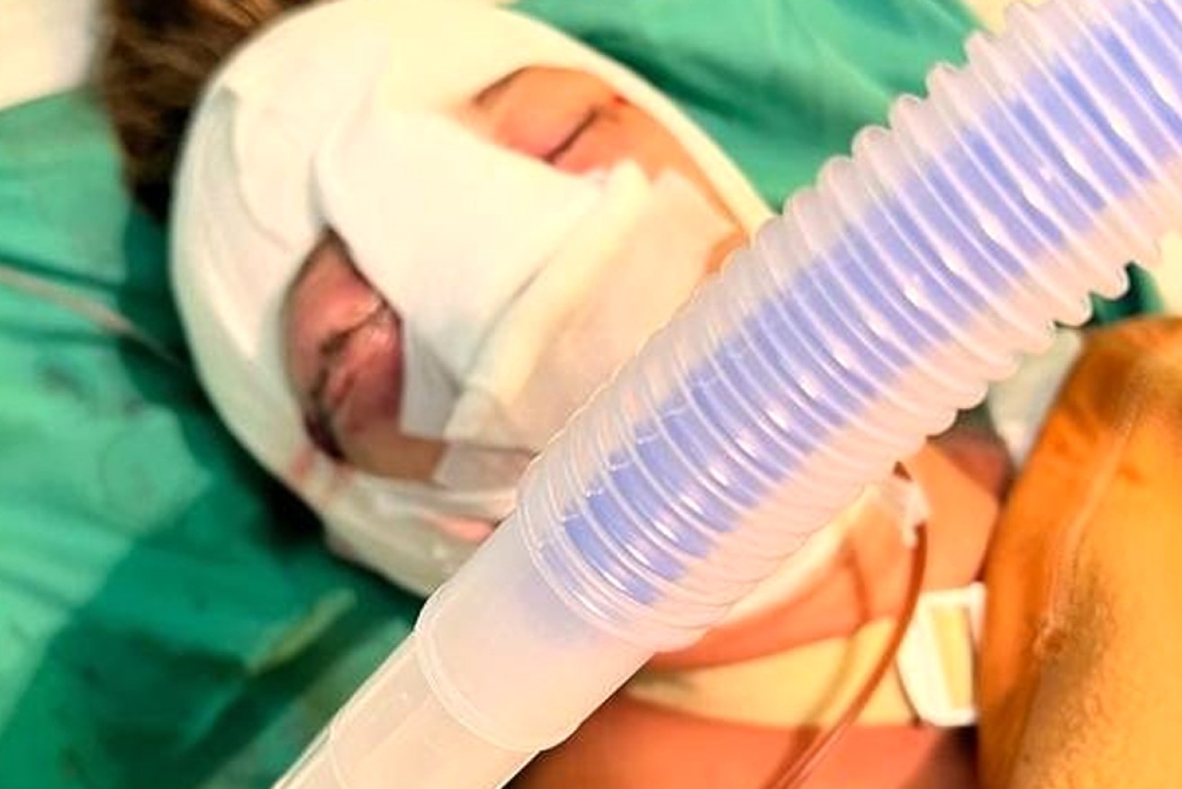Rebecca Ode remains in hospital in Bali after suffering horrific injuries in a mystery accident.