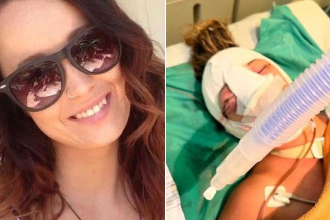 Rebecca Ode was living in Bali when she suffered life-changing injuries.