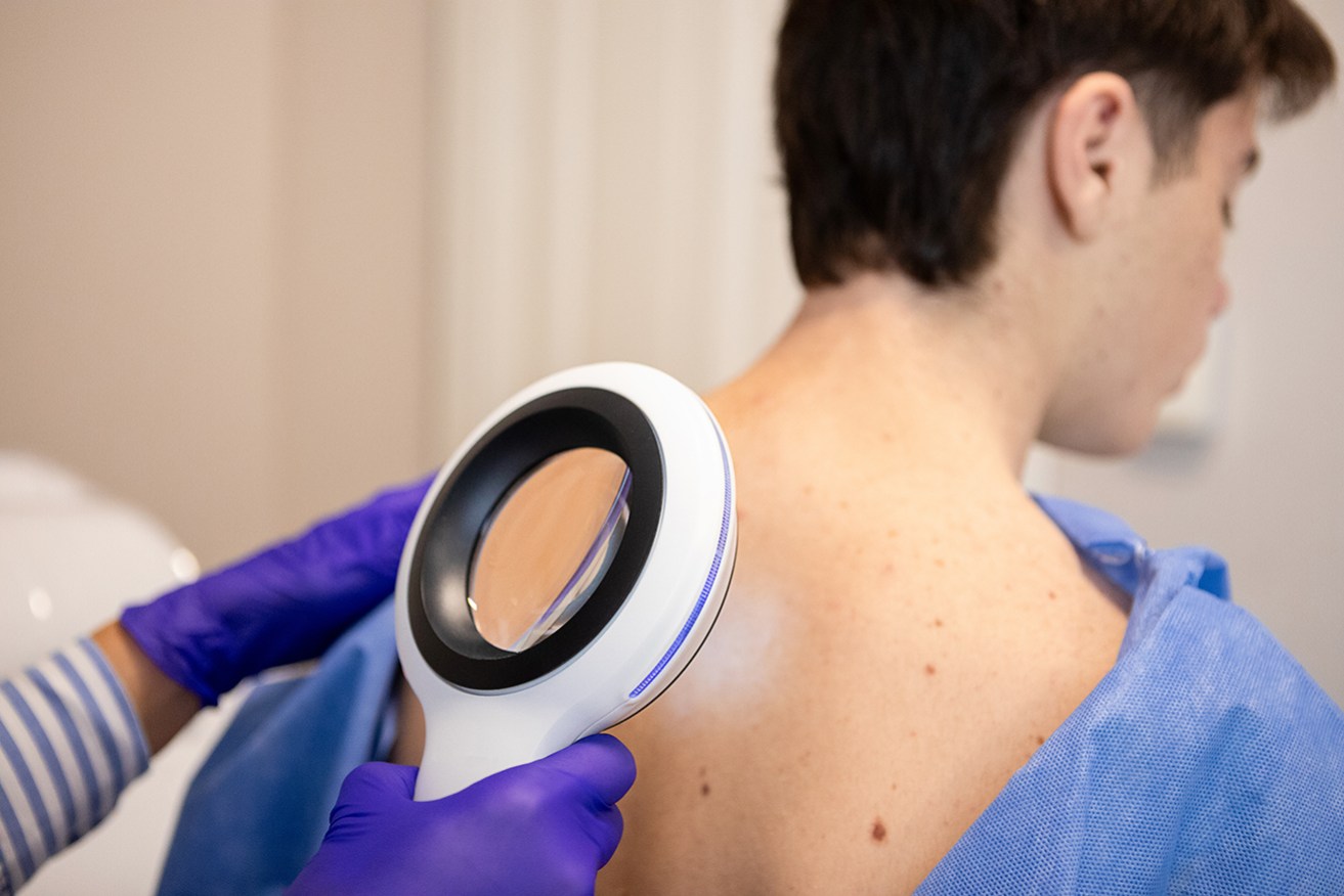 An unknown number of people aren't seeking treatment for squamous cell carcinoma.