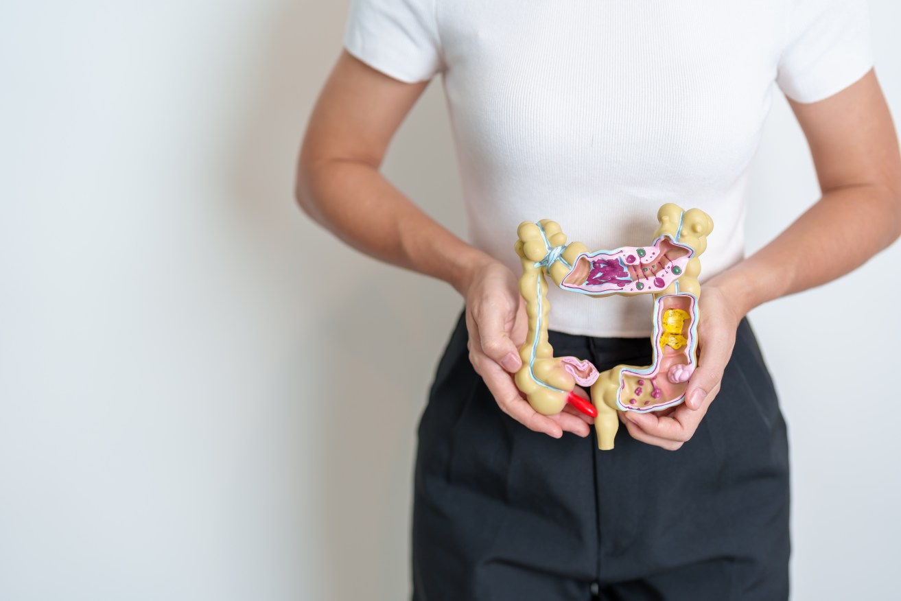 A high fibre diet and drinking plenty of water might save you from developing pockets in your bowel.