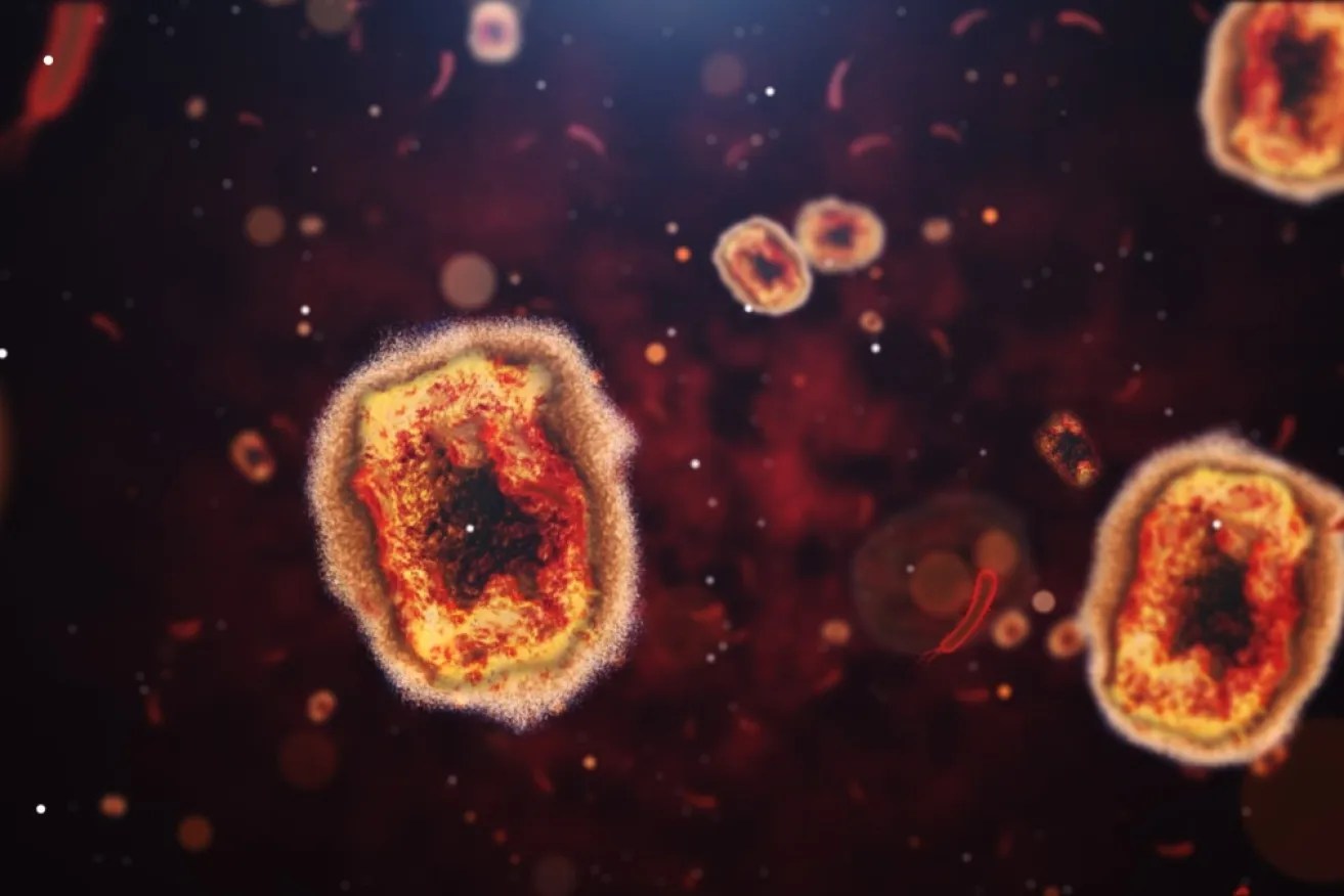 As the number of mpox cases in Australia climbs to the highest numbers yet, Victoria's chief health officer has warned that anyone can be affected.