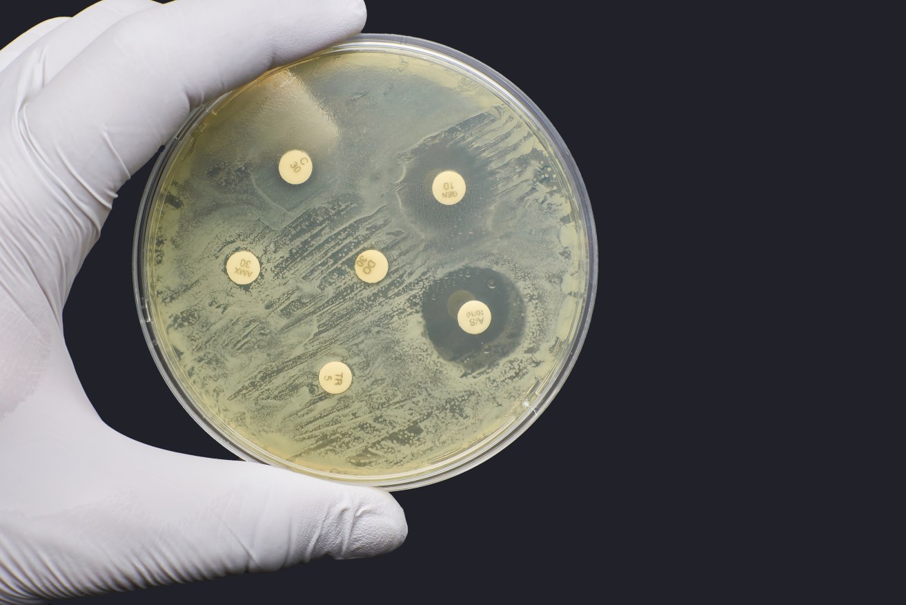 Antimicrobial-resistant infections can be caused by bacteria, viruses and fungi.
