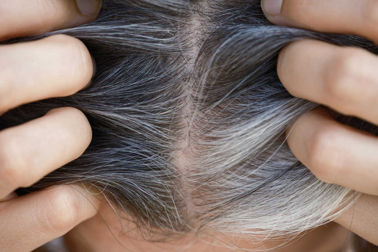 Grey hair has very little melanin, while white hair has none left.