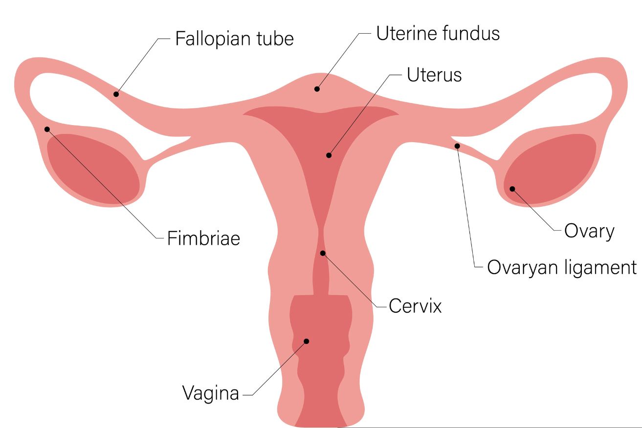 Most ovarian cancer cases are detected at a late stage.