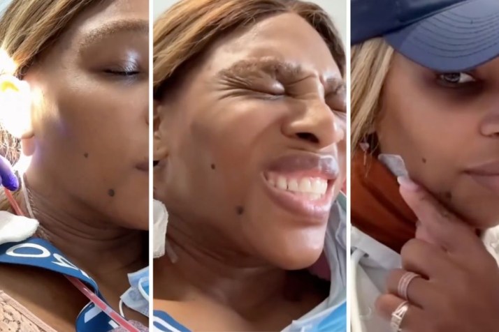 Will Serena Williams’ giant lump come back?