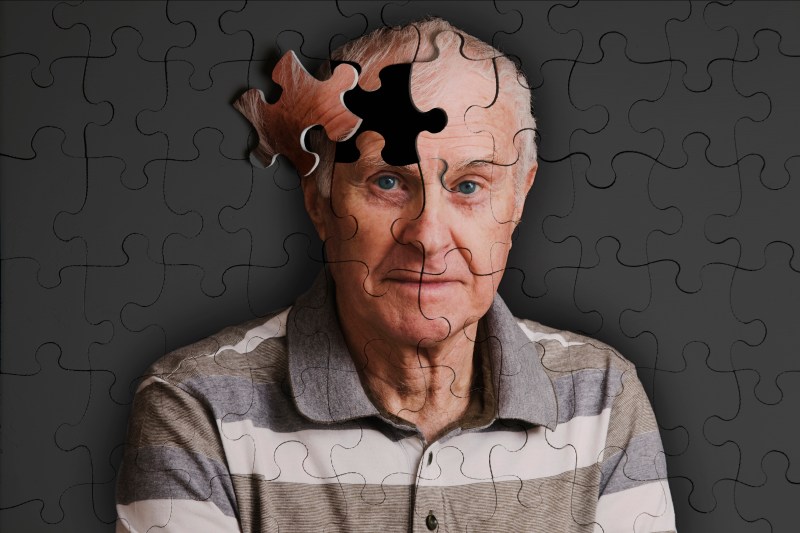 Alzheimer's