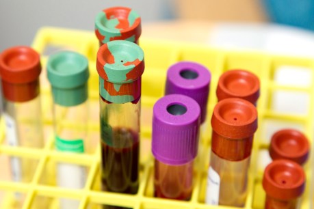 Off-switch found for known driver of prostate cancer